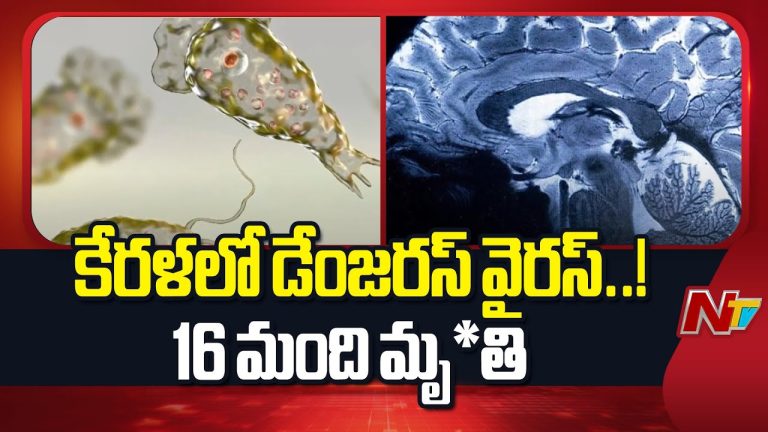 Kerala : కేరళను వణికిస్తున్న బ్రెయిన్ ఈటింగ్ వైరస్ ఇప్పటి వరకూ 16 మంది మృతి.. ప్రజల్లో ఆందోళన