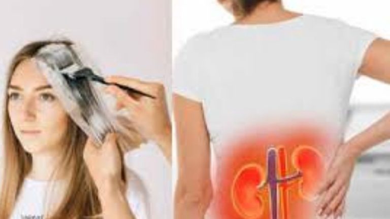 Kidney Disease: హెయిర్ డై వాడుతున్నారా.. అయితే జాగ్రత..