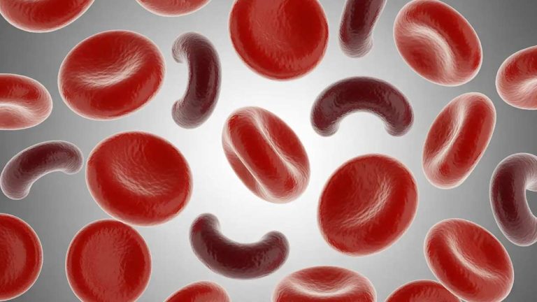 Anemia Causes: రక్తహీనత వేధిస్తే ఎలాంటి సమస్యలు వస్తాయో తెలుసా?