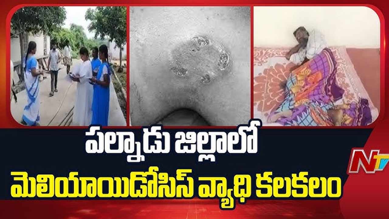 Melioidosis Disease: పల్నాడులో మెలియాయిడోసిస్ వ్యాధి కలకలం..
