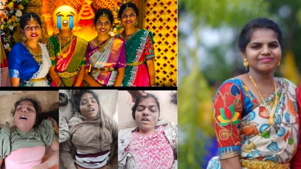 Chevella Road Incident