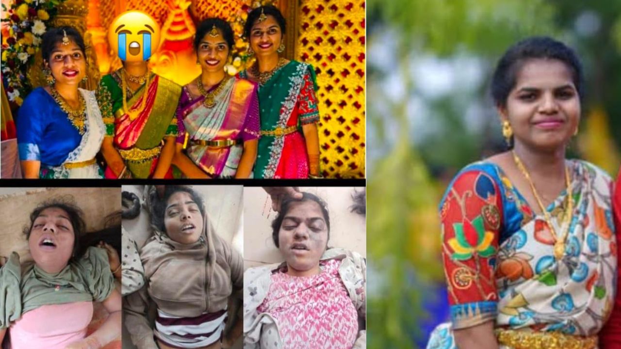 Chevella Road Incident: 24కు చేరిన మృతుల సంఖ్య.. ఒకే కుటుంబానికి చెందిన ముగ్గురు యువతుల మృతి..!