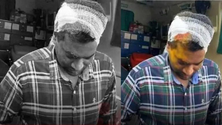 Hyderabad: శుభకార్యంలో రెచ్చిపోయిన హిజ్రాలు.. డబ్బులు ఇవ్వలేదని గుంపుగా దాడి