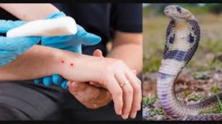 Snake Bite: పాము కాటు వేసిందా?.. కంగారు పడకుండా ఈ సూచనలు పాటిస్తే సరి!