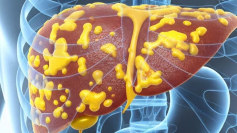Natural Liver Detox: సహజ పద్ధతుల ద్వారా కాలేయాన్ని శుభ్రపరిచే పక్రియ.. ఎంటో మీకు తెలుసా