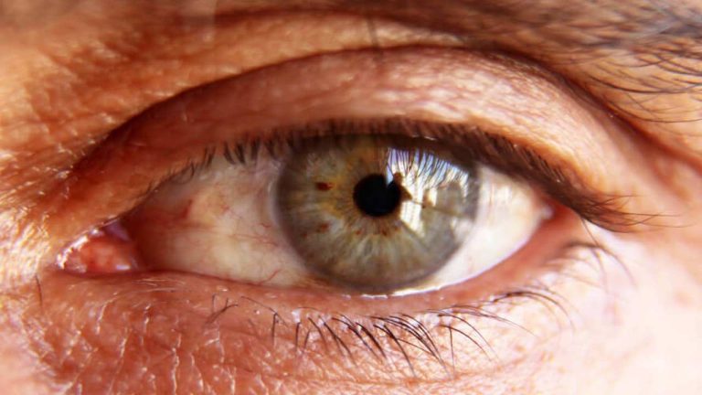 Diabetes Eye Symptoms: ఈ తీవ్రమైన వ్యాధి లక్షణాలు మీ కళ్లలో కనిపిస్తున్నాయా?