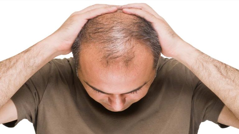 Health Tips: ఈ పని చేస్తే మీ జుట్టు రాలదు..