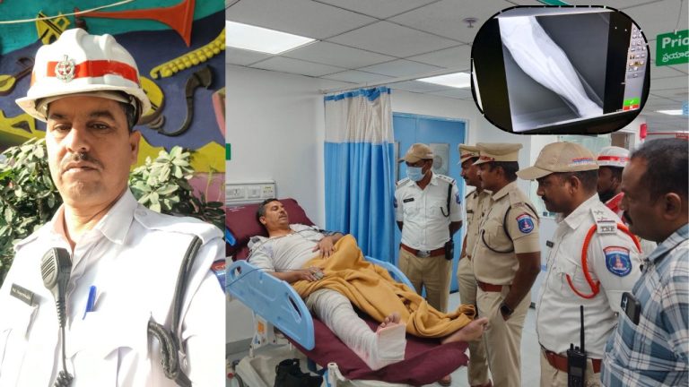 Hit And Run: మాదాపూర్‌లో హిట్ అండ్ రన్.. ట్రాఫిక్ హోమ్ గార్డ్‌ను ఢీకొట్టి పరారీ అయిన కారు డ్రైవర్