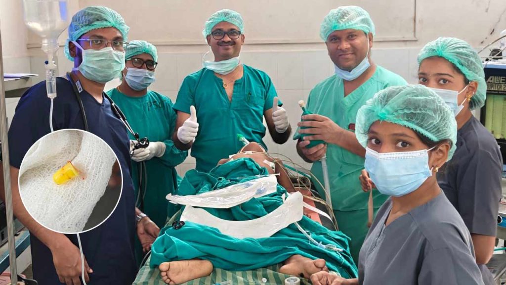 Rare Surgery At Ruia Hospit