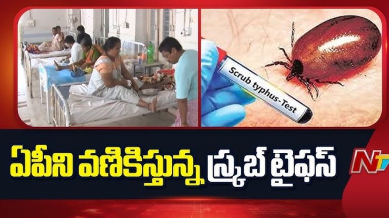 Scrub Typhus: స్క్రబ్ టైఫస్‌పై ఆందోళన అవసరం లేదు.. సమగ్ర చర్యలు తీసుకుంటున్నాం..!