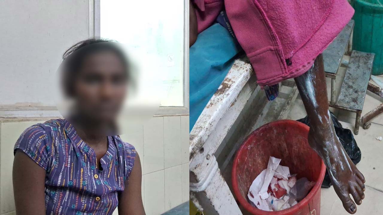 Chemical Attack : హనుమకొండలో షాకింగ్.. నర్సింగ్ విద్యార్థినిపై కెమికల్ దాడి