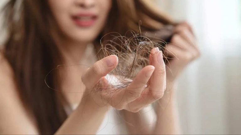 Hair Fall Reasons: మీ జుట్టు విపరీతంగా రాలిపోతుందా! ఎందుకో తెలుసుకోండి..