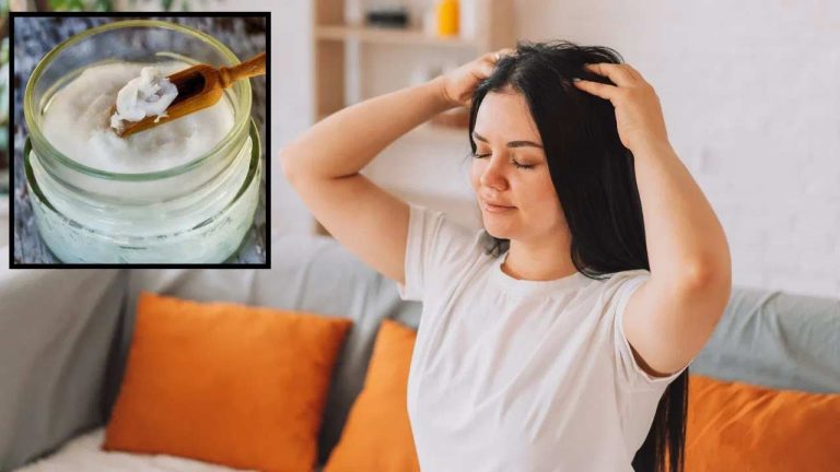 Healthy Hair: చుండ్రుకు చెక్ పెడుతున్న మ్యాజిక్ హెయిర్ ఆయిల్..