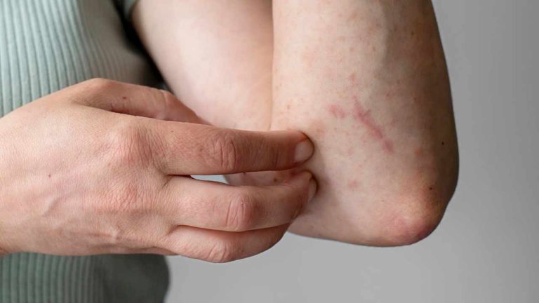 Health Tips:  ఈ చర్మ లక్షణాలను విస్మరించవద్దు, అవి మధుమేహానికి సంకేతం కావచ్చు