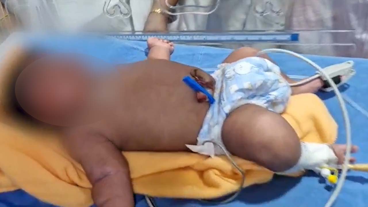 Viral News : భద్రాచలంలో ‘బాలభీముడు’.. 5.2 కేజీల బరువుతో శిశువు జననం..