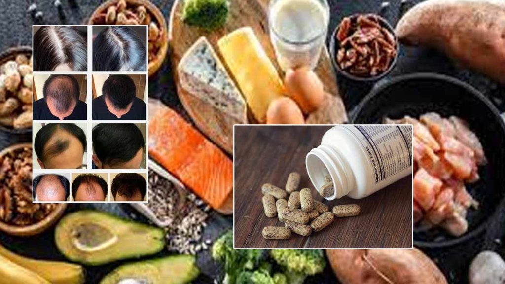 Biotin For Hair Loss