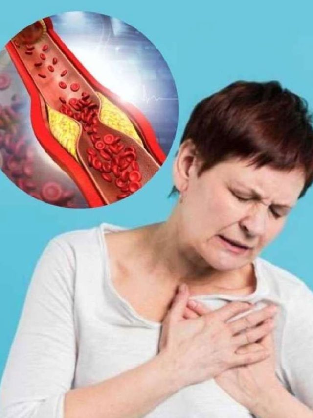 చెడు కొలెస్ట్రాల్‌ని తరిమికొట్టే 10 సూపర్ ఫుడ్స్ ఇవే !