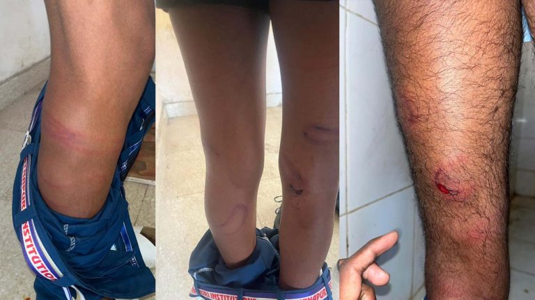 Sangareddy: హోంవర్క్ చేయలేదని విద్యార్థులపై దాడి.. కేబుల్ వైర్లతో కొట్టిన వైనం..!