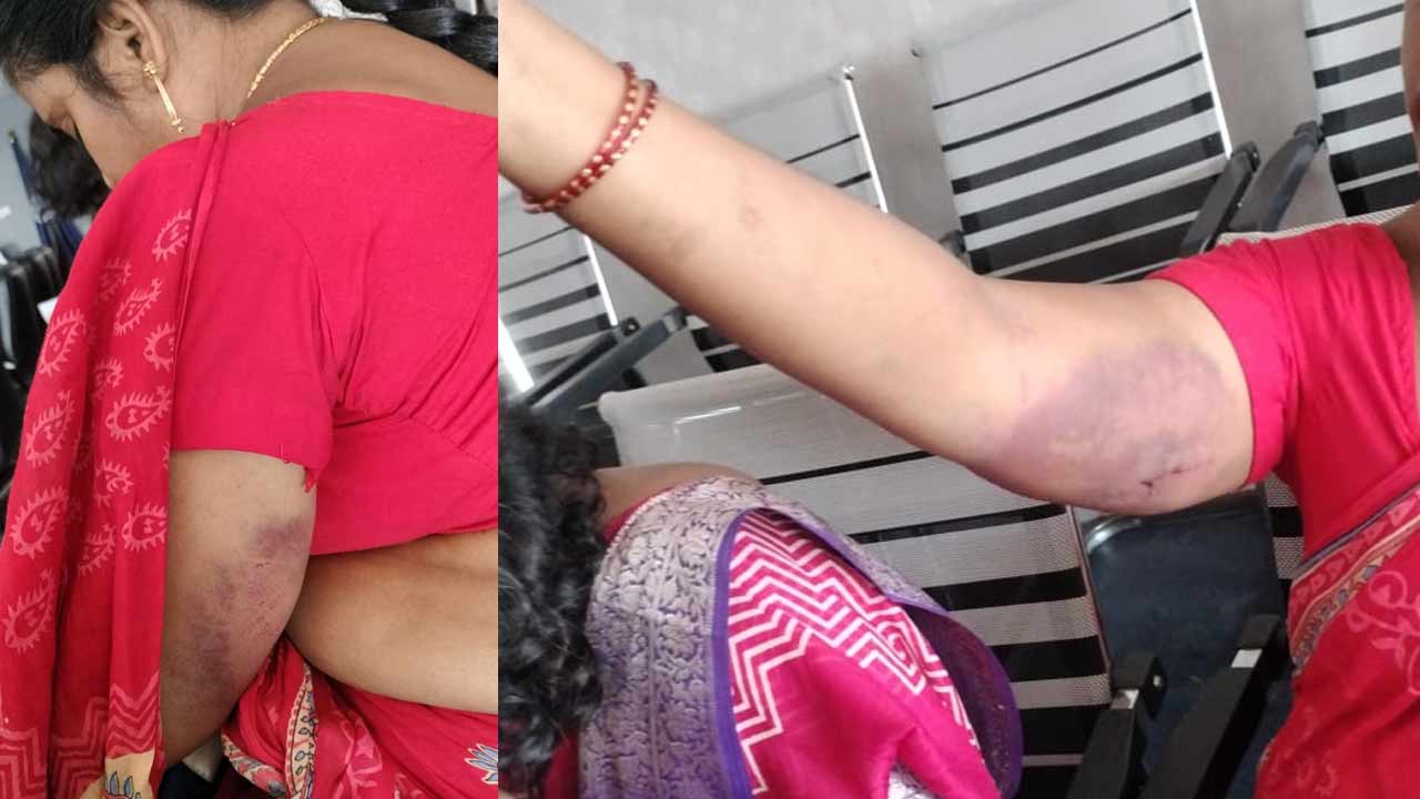 Land Dispute Turns Violent: స్థల వివాదం.. ఐదుగురు మహిళలపై విచక్షణారహితంగా దాడి..