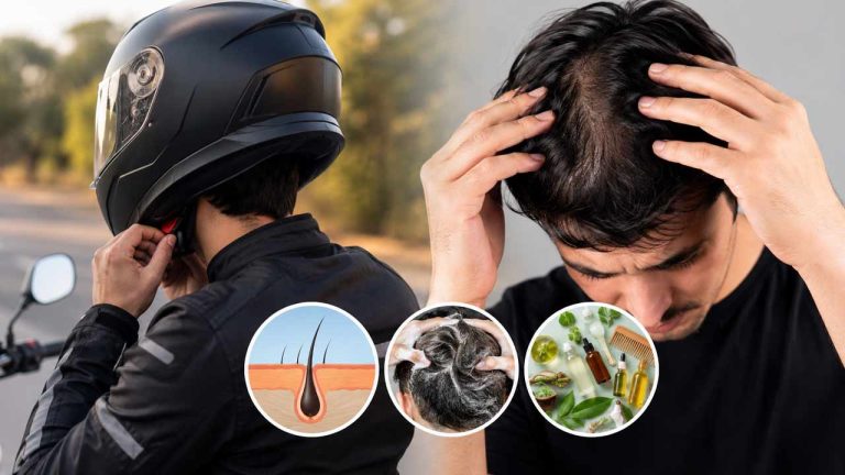 Helmet and Hair Loss: హెల్మెట్ వల్ల నిజంగా జుట్టు రాలుతుందా..? వైద్యులు చెప్పిన అసలు నిజం ఇదే..