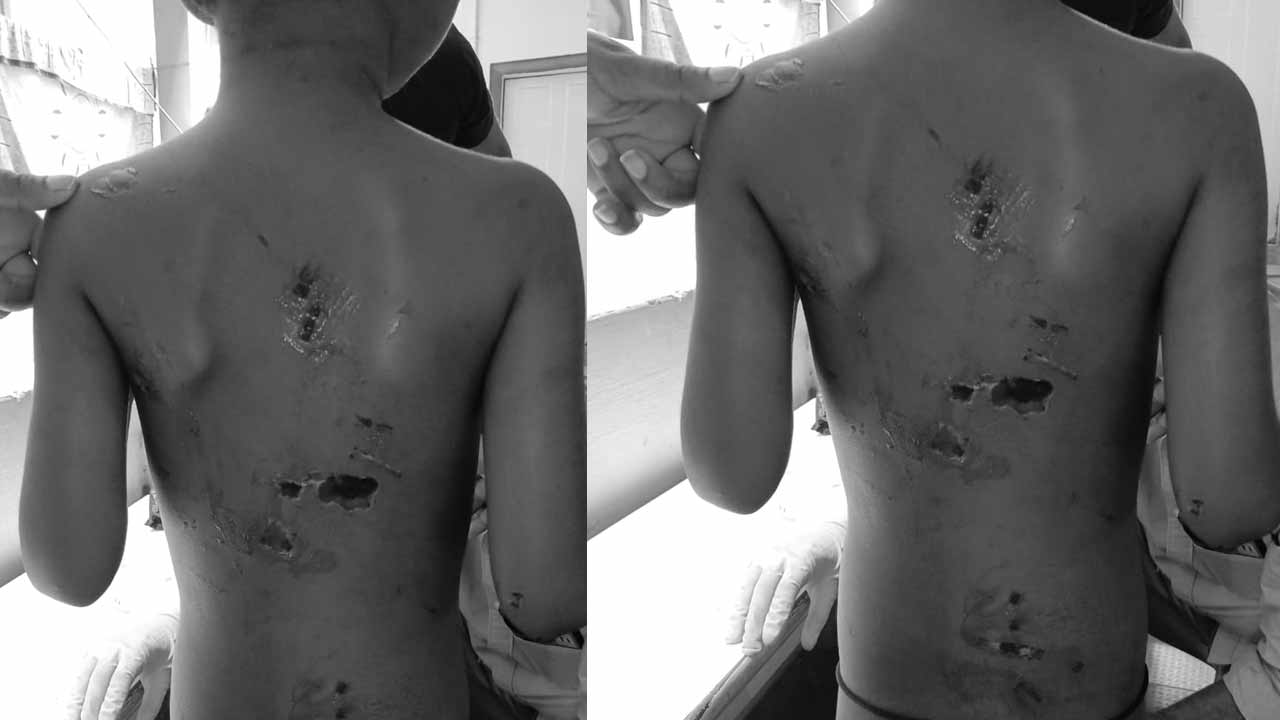 chittoor horror seven year old boy allegedly tortured by mother and her partner