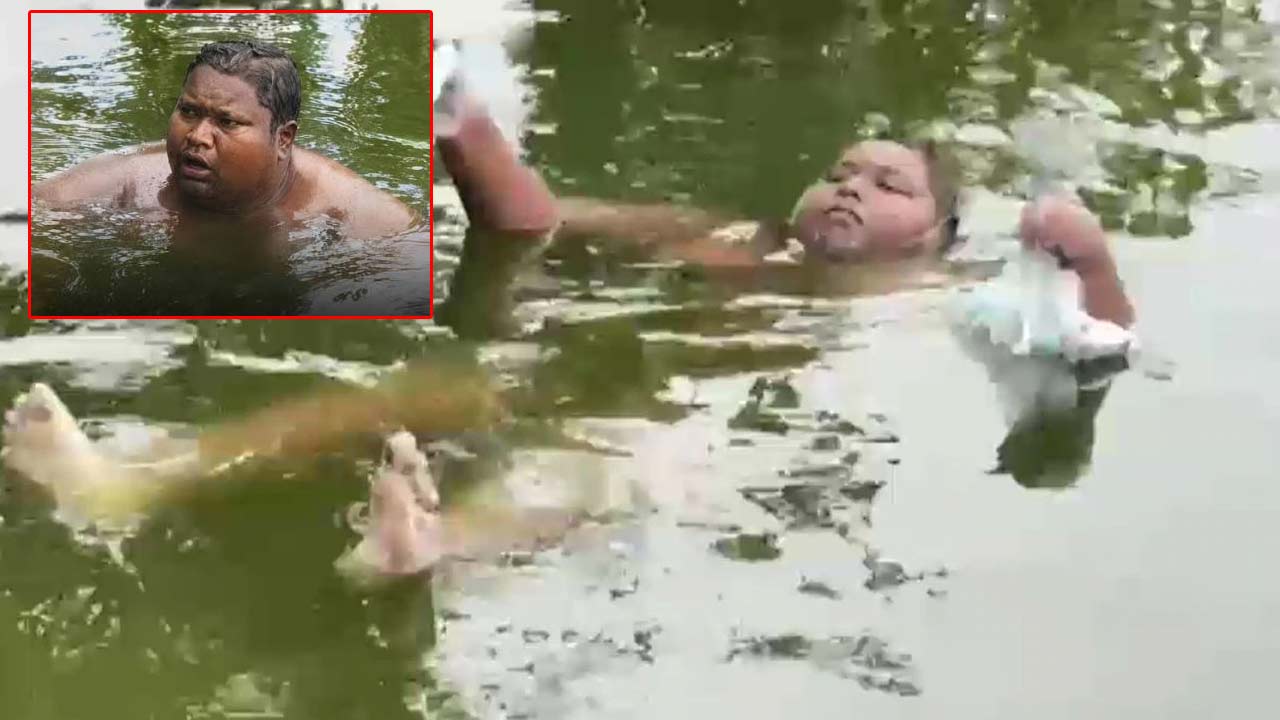 16 year old boy lives in pond for 5 years says water relieves burning sensation