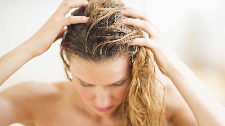 Scalp Care Tips : చలికాలంలో చుండ్రు వేధిస్తోందా? ఈజీ అండ్ నాచురల్ చిట్కాలతో చెక్‌ పెట్టండిలా